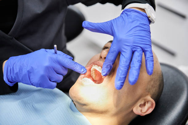 Best Emergency Dental Care for Broken or Chipped Teeth in Butner, NC